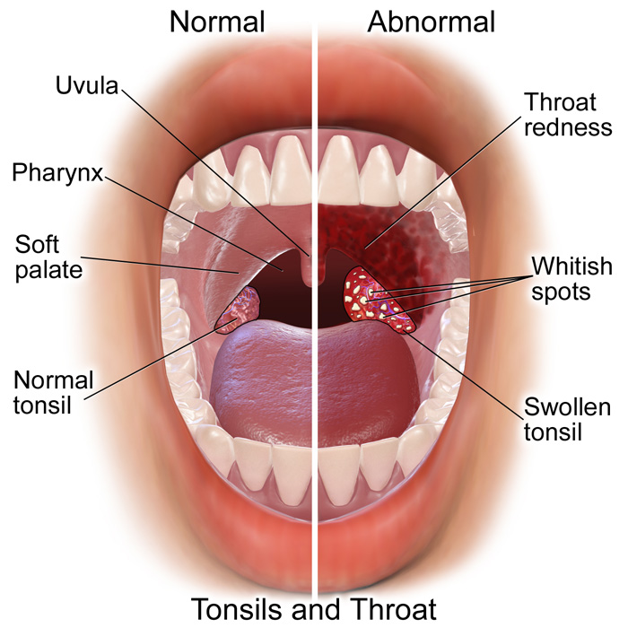 Normal Back Of Throat 5
